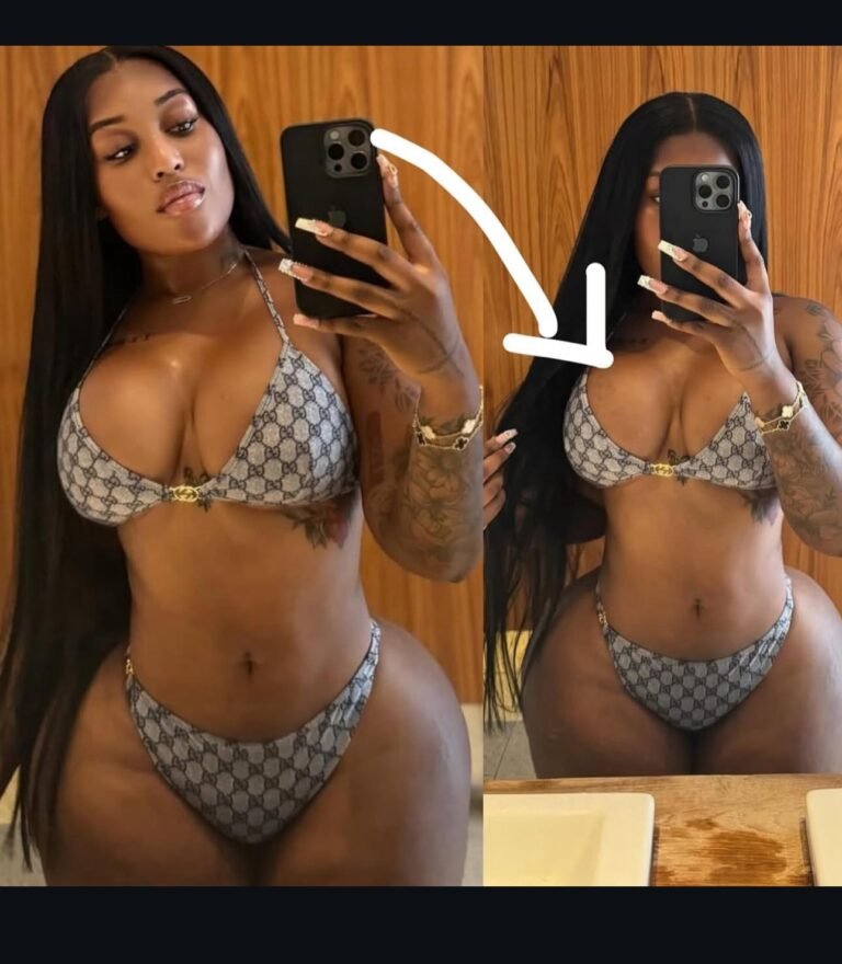 Fantana’s breast augmentation surgery ignites debate on social media