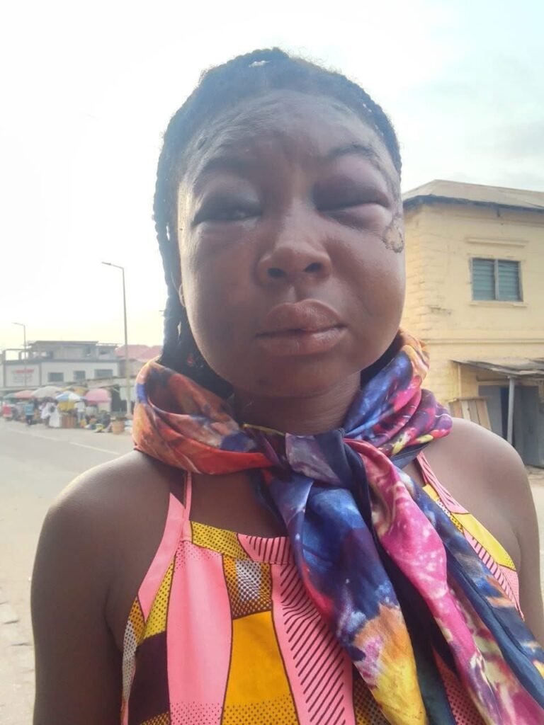 Nigerian sex worker assaulted by a client over GH¢50 payment
