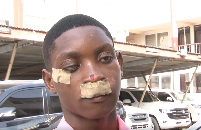 Obrachire SHS Student assaulted speaks