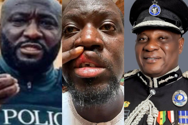 Commotion as Police CLEARS Black Maria Team over alleged assault of Ibrahim Mahama