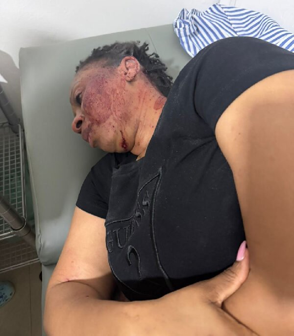 BREAKING – Adwoa Safo injured after gunmen open fire on her car